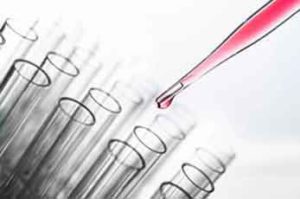 pipette with test tubes - health and fitness translation